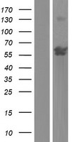Western blot validation of overexpression lysate (Cat# LY430049) using anti-DDK antibody (Cat# TA50011-100). Left: Cell lysates from un-transfected HEK293T cells; Right: Cell lysates from HEK293T cells transfected with RC225912 using transfection reagent MegaTran 2.0 (Cat# TT210002).
