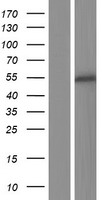 Western blot validation of overexpression lysate (Cat# LY425318) using anti-DDK antibody (Cat# TA50011-100). Left: Cell lysates from un-transfected HEK293T cells; Right: Cell lysates from HEK293T cells transfected with RC225594 using transfection reagent MegaTran 2.0 (Cat# TT210002).