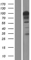 Western blot validation of overexpression lysate (Cat# LY434420) using anti-DDK antibody (Cat# TA50011-100). Left: Cell lysates from un-transfected HEK293T cells; Right: Cell lysates from HEK293T cells transfected with RC231421 using transfection reagent MegaTran 2.0 (Cat# TT210002).