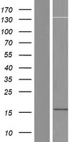 Western blot validation of overexpression lysate (Cat# LY433954) using anti-DDK antibody (Cat# TA50011-100). Left: Cell lysates from un-transfected HEK293T cells; Right: Cell lysates from HEK293T cells transfected with RC230955 using transfection reagent MegaTran 2.0 (Cat# TT210002).