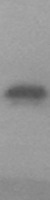Western blot validation of overexpression lysate (Cat# LY434074) using anti-DDK antibody (Cat# TA50011-100). Left: Cell lysates from un-transfected HEK293T cells; Right: Cell lysates from HEK293T cells transfected with RC231075 using transfection reagent MegaTran 2.0 (Cat# TT210002).
