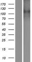 Western blot validation of overexpression lysate (Cat# LY433861) using anti-DDK antibody (Cat# TA50011-100). Left: Cell lysates from un-transfected HEK293T cells; Right: Cell lysates from HEK293T cells transfected with RC230862 using transfection reagent MegaTran 2.0 (Cat# TT210002).