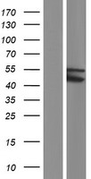 Western blot validation of overexpression lysate (Cat# LY433834) using anti-DDK antibody (Cat# TA50011-100). Left: Cell lysates from un-transfected HEK293T cells; Right: Cell lysates from HEK293T cells transfected with RC230835 using transfection reagent MegaTran 2.0 (Cat# TT210002).