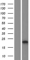 Western blot validation of overexpression lysate (Cat# LY433944) using anti-DDK antibody (Cat# TA50011-100). Left: Cell lysates from un-transfected HEK293T cells; Right: Cell lysates from HEK293T cells transfected with RC230945 using transfection reagent MegaTran 2.0 (Cat# TT210002).