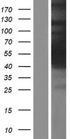 Western blot validation of overexpression lysate (Cat# LY413958) using anti-DDK antibody (Cat# TA50011-100). Left: Cell lysates from un-transfected HEK293T cells; Right: Cell lysates from HEK293T cells transfected with RC200877 using transfection reagent MegaTran 2.0 (Cat# TT210002).