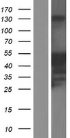 Western blot validation of overexpression lysate (Cat# LY408251) using anti-DDK antibody (Cat# TA50011-100). Left: Cell lysates from un-transfected HEK293T cells; Right: Cell lysates from HEK293T cells transfected with RC203004 using transfection reagent MegaTran 2.0 (Cat# TT210002).