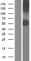 Western blot validation of overexpression lysate (Cat# LY416639) using anti-DDK antibody (Cat# TA50011-100). Left: Cell lysates from un-transfected HEK293T cells; Right: Cell lysates from HEK293T cells transfected with RC203203 using transfection reagent MegaTran 2.0 (Cat# TT210002).