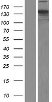 Western blot validation of overexpression lysate (Cat# LY414973) using anti-DDK antibody (Cat# TA50011-100). Left: Cell lysates from un-transfected HEK293T cells; Right: Cell lysates from HEK293T cells transfected with RC206994 using transfection reagent MegaTran 2.0 (Cat# TT210002).
