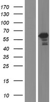 Western blot validation of overexpression lysate (Cat# LY413545) using anti-DDK antibody (Cat# TA50011-100). Left: Cell lysates from un-transfected HEK293T cells; Right: Cell lysates from HEK293T cells transfected with RC224958 using transfection reagent MegaTran 2.0 (Cat# TT210002).