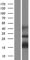 Western blot validation of overexpression lysate (Cat# LY433922) using anti-DDK antibody (Cat# TA50011-100). Left: Cell lysates from un-transfected HEK293T cells; Right: Cell lysates from HEK293T cells transfected with RC230923 using transfection reagent MegaTran 2.0 (Cat# TT210002).