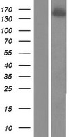 Western blot validation of overexpression lysate (Cat# LY415687) using anti-DDK antibody (Cat# TA50011-100). Left: Cell lysates from un-transfected HEK293T cells; Right: Cell lysates from HEK293T cells transfected with RC203519 using transfection reagent MegaTran 2.0 (Cat# TT210002).