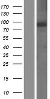 Western blot validation of overexpression lysate (Cat# LY414745) using anti-DDK antibody (Cat# TA50011-100). Left: Cell lysates from un-transfected HEK293T cells; Right: Cell lysates from HEK293T cells transfected with RC218135 using transfection reagent MegaTran 2.0 (Cat# TT210002).