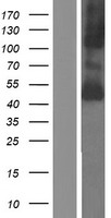 Western blot validation of overexpression lysate (Cat# LY412996) using anti-DDK antibody (Cat# TA50011-100). Left: Cell lysates from un-transfected HEK293T cells; Right: Cell lysates from HEK293T cells transfected with RC209881 using transfection reagent MegaTran 2.0 (Cat# TT210002).