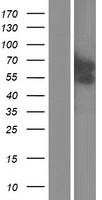 Western blot validation of overexpression lysate (Cat# LY417758) using anti-DDK antibody (Cat# TA50011-100). Left: Cell lysates from un-transfected HEK293T cells; Right: Cell lysates from HEK293T cells transfected with RC210179 using transfection reagent MegaTran 2.0 (Cat# TT210002).
