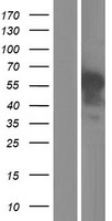 Western blot validation of overexpression lysate (Cat# LY402565) using anti-DDK antibody (Cat# TA50011-100). Left: Cell lysates from un-transfected HEK293T cells; Right: Cell lysates from HEK293T cells transfected with RC214158 using transfection reagent MegaTran 2.0 (Cat# TT210002).