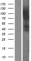Western blot validation of overexpression lysate (Cat# LY409559) using anti-DDK antibody (Cat# TA50011-100). Left: Cell lysates from un-transfected HEK293T cells; Right: Cell lysates from HEK293T cells transfected with RC202537 using transfection reagent MegaTran 2.0 (Cat# TT210002).