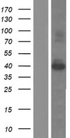 Western blot validation of overexpression lysate (Cat# LY415681) using anti-DDK antibody (Cat# TA50011-100). Left: Cell lysates from un-transfected HEK293T cells; Right: Cell lysates from HEK293T cells transfected with RC219010 using transfection reagent MegaTran 2.0 (Cat# TT210002).