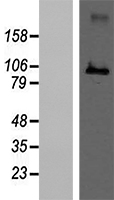 Western validation with an anti-DDK antibody; L: Control HEK293 lysate R: Over-expression lysate