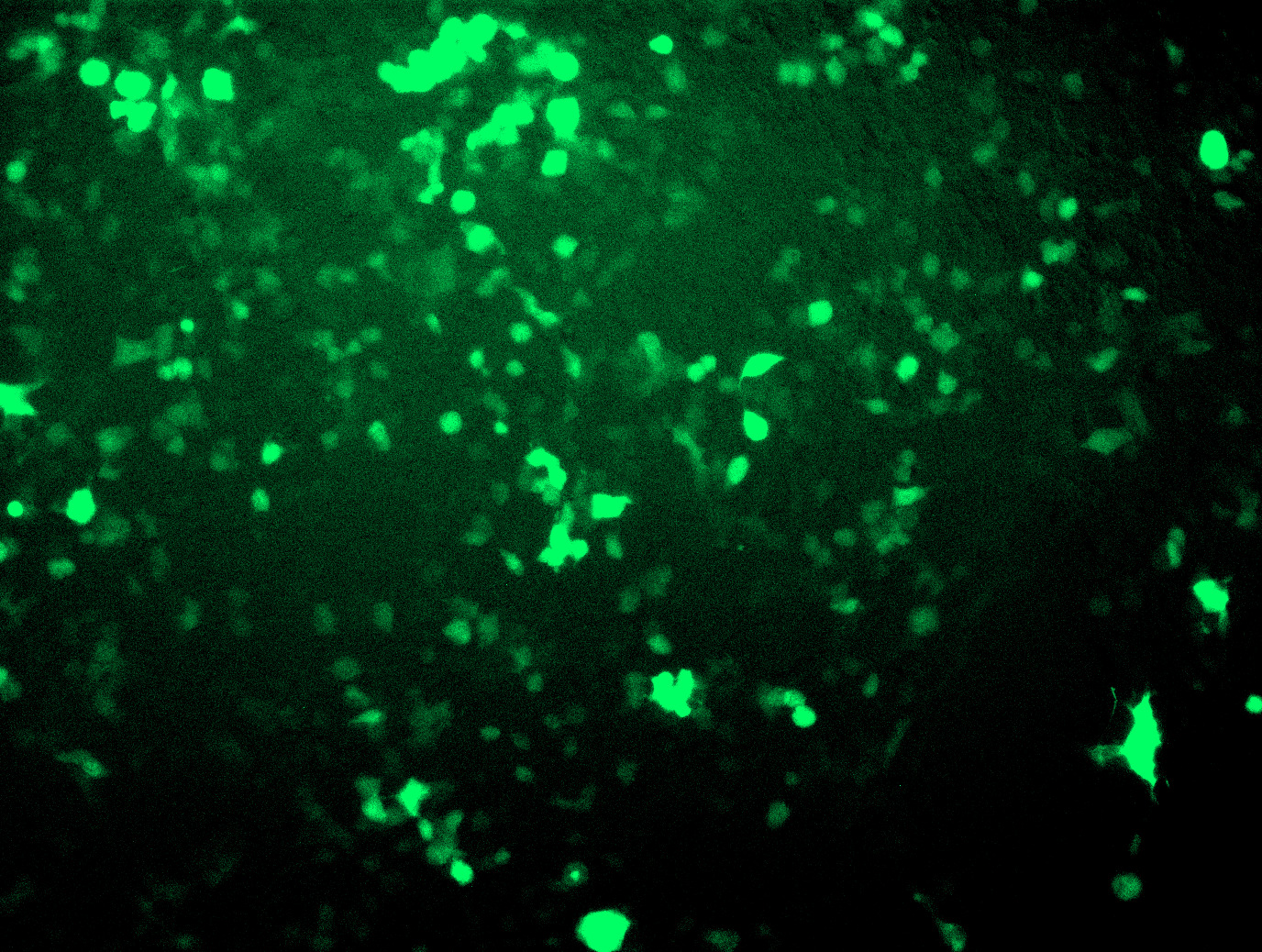 Data image of AAV5-CMV-GFP Control Particle.