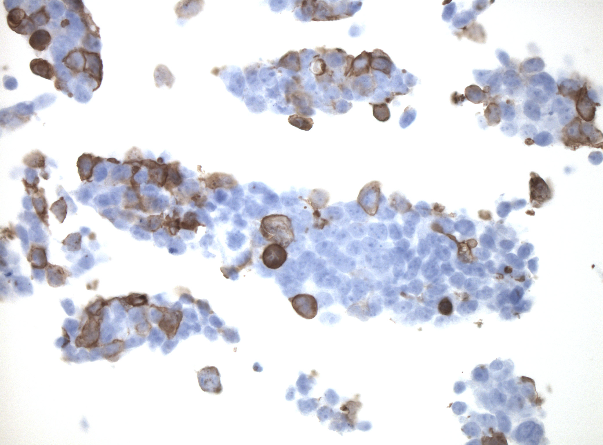 Immunohistology staining on GRP84 overexpressed cytosection TS404621P5 with rabbit anti DDK clone OTIR5G2 C/N TA592569 at 1:2000 dilution 20m RT. Antibody staining was achieved with HIER Citrate pH6 , Polink1 with DAB chromogen detection kit (D11-18). Positive stain shown with the brown chromogen present. HEK293T cells were transfected with cDNA clone RC204621, 5 micron sections, 40x magnification