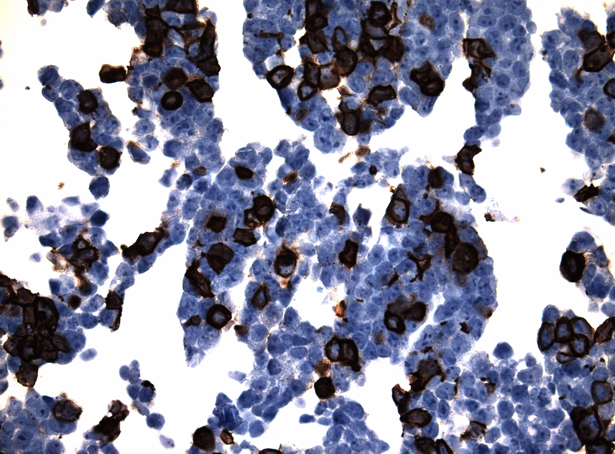 Immunohistology staining on HCAR2 overexpressed cytosection TS406527P5 with mouse anti DDK clone OTI11C3 C/N TA180144 at 1:400 dilution 4C O/N. Antibody staining was achieved with HIER Citrate pH6 , Polink1 with DAB chromogen detection kit (D11-18). Positive stain shown with the brown chromogen present. HEK293T cells were transfected with cDNA clone RC406527, 5 micron sections, 40x magnification