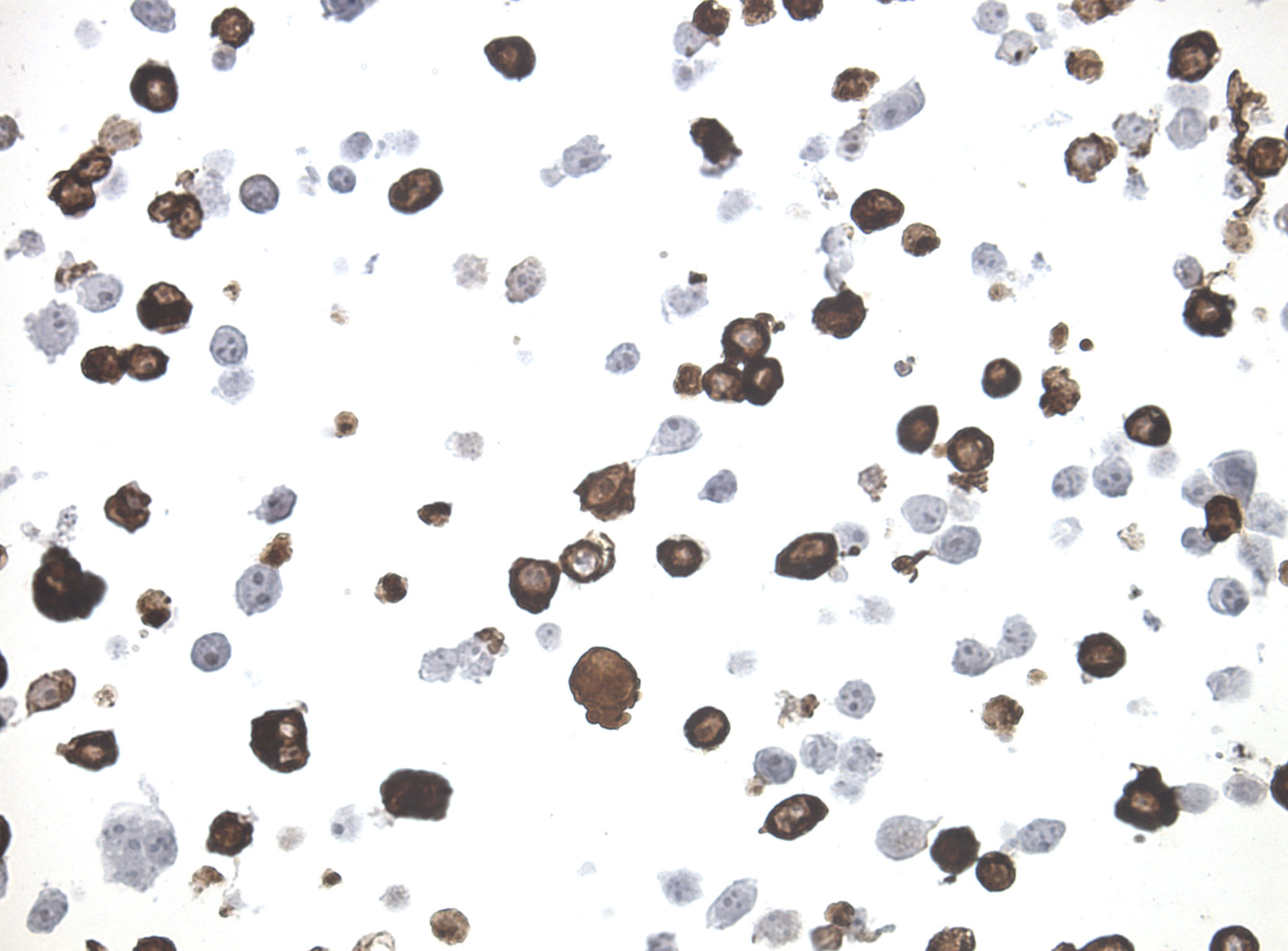 Immunohistology staining on PCDHA13 overexpressed cytosection TS419904P5 with mouse anti DDK clone OTI11C3 C/N TA180144 at 1:400 dilution 4C O/N. Antibody staining was achieved with HIER Citrate pH6 , Polink1 with DAB chromogen detection kit (D11-18). Positive stain shown with the brown chromogen present. HEK293T cells were transfected with cDNA clone RC219904, 5 micron sections, 40x magnification