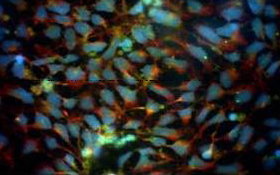 Image: Immunofluorescence for hN2 Human Neurons Discovery Kit differentiated in the presence of 25 ng/ml GDNF. Cells were also counterstained for nuclei (DAPI) and Tuj 1-Neuron-specific class III beta-tubulin and TH-Tyrosine Hydroxylase.