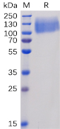 Figure 1. Human CEACAM5 Protein, His Tag on SDS-PAGE under reducing condition.