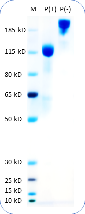 Human HER2 Protein (C-Fc) on SDS-PAGE under reducing condition P(+) and non-reducing condition P(-). The purity of this protein appears to be greater than 90% based on Coomassie-blue staining.