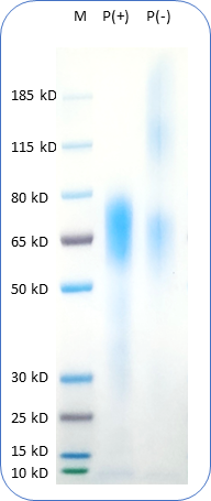 Human CD30 Protein (C-His) on SDS-PAGE under reducing condition P(+) and non-reducing condition P(-). The purity of this protein appears to be greater than 90% based on Coomassie-blue staining.