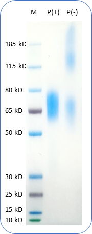 Human CD30 Protein (C-His-Avi) on SDS-PAGE under reducing condition P(+) and non-reducing condition P(-). The purity of this protein appears to be greater than 90% based on Coomassie-blue staining.