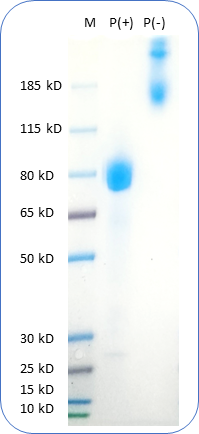 Human IL13RA2 Protein (C-Fc-Avi) on SDS-PAGE under reducing condition P(+) and non-reducing condition P(-). The purity of this protein appears to be greater than 95% based on Coomassie-blue staining.
