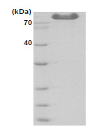 DMG (N,N-dimethylglycine oxidase) (23-198, His-tag) Human Protein