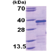 EBAG9 / RCAS1 (28-213, His-tag) Human Protein