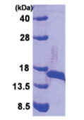 DsbE (26-185) Escherichia coli Protein DsbE (26-185) Escherichia coli Protein
