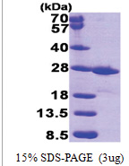 FKBP14 / FKBP22 (20-211, His-tag) Human Protein