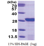 PDAP1 (1-181, His-tag) Human Protein PDAP1 (1-181, His-tag) Human Protein