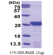 PDAP1 (1-181, His-tag) Human Protein PDAP1 (1-181, His-tag) Human Protein
