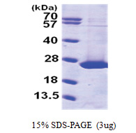 ARL1 (1-181, His-tag) Human Protein