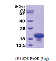 PFDN2 (1-154, His-tag) Human Protein