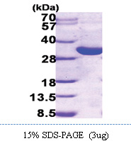 17-beta HSD14 / HSD17B14 (1-270, His-tag) Human Protein