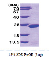 MDP1 (1-176, His-tag) Human Protein