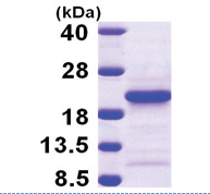 PFDN4 (1-134, His-tag) Human Protein