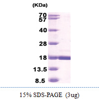 Retinoid-binding protein 7 / RBP7 (1-134, His-tag) Human Protein