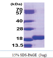 MAP1LC3B2 (1-120, His-tag) Human Protein