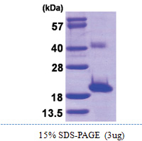 Sentan / SNTN (1-147, His-tag) Human Protein