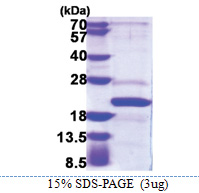 AP1 complex subunit sigma-2 / AP1S2 (1-157, His-tag) Human Protein