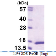 MYL5 (1-132, His-tag) Human Protein