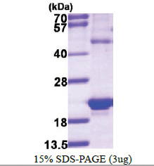 HSPB3 (1-150, His-tag) Human Protein HSPB3 (1-150, His-tag) Human Protein