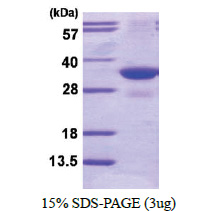 PSMG2 / PAC2 (1-264, His-tag) Human Protein PSMG2 / PAC2 (1-264, His-tag) Human Protein